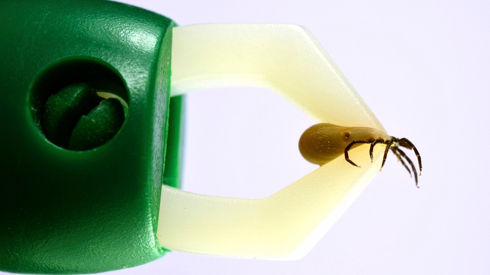 Im Bild eine Zeckenzange. Um eine Borreliose-Infektion und das Risiko einer FSME-Erkrankung nach einem Zeckenstich zu minimieren, sollte die Zecke möglichst rasch entfernt werden. So macht ihr bei der Zeckenentfernung alles richtig.  | Bild: picture alliance / imageBROKER / Mario Hösel